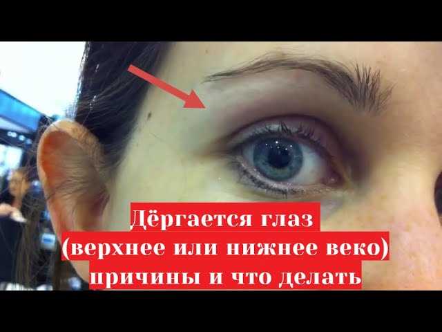 Почему дергается глаз и как справиться с этой проблемой