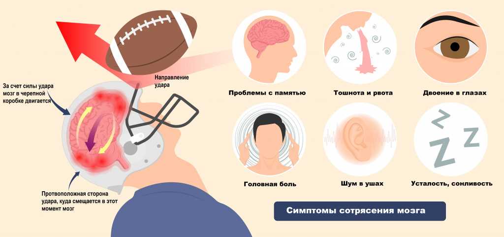 Что нельзя делать после сотрясения мозга