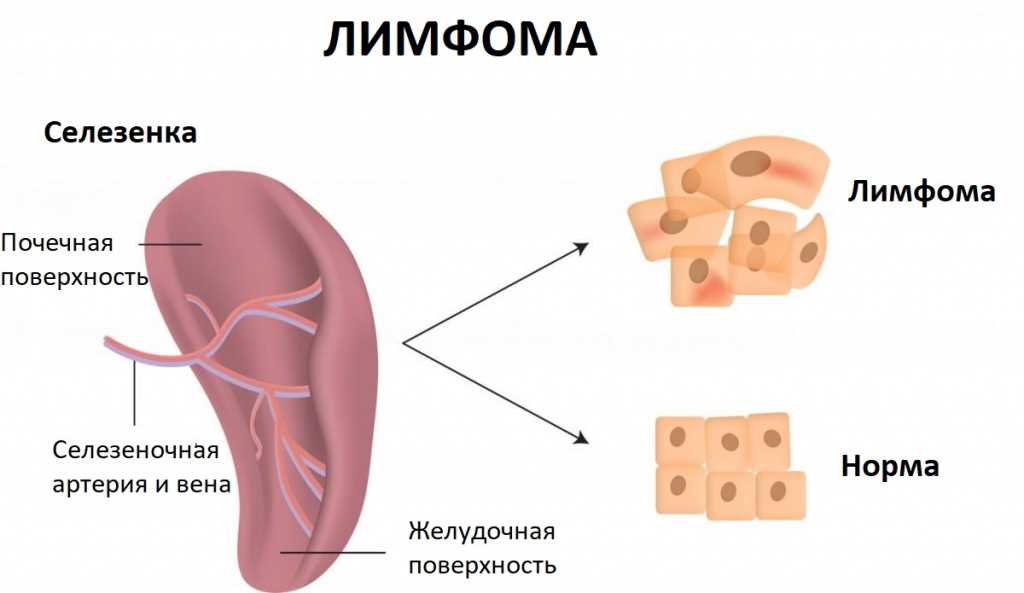 Что такое селезенка и с какой стороны она находится у человека?