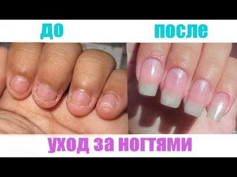 Питание для роста и крепости ногтей; как сделать так чтобы ногти не ломались