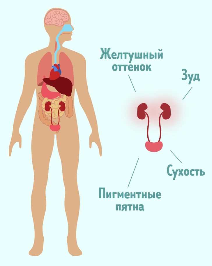 Какие признаки болезни почек у женщин