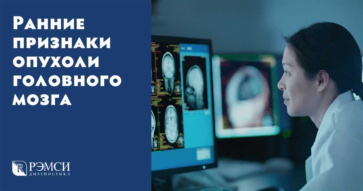 Рентгеновское исследование головного мозга для выявления рака