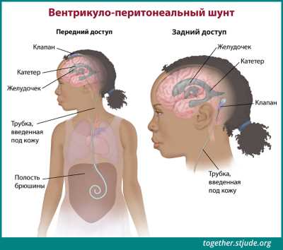 Магнитно-резонансная томография (МРТ) для точной диагностики рака головного мозга