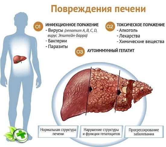 Ингредиенты для приготовления печенки на сковороде: