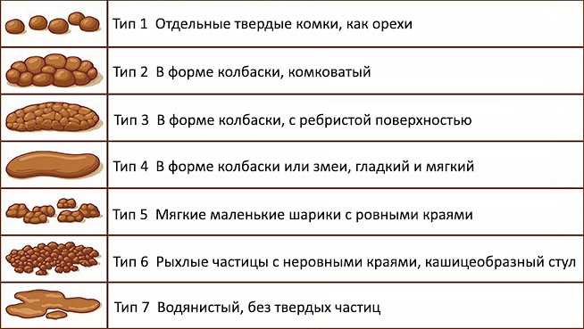 Запор: причины, симптомы и лечение