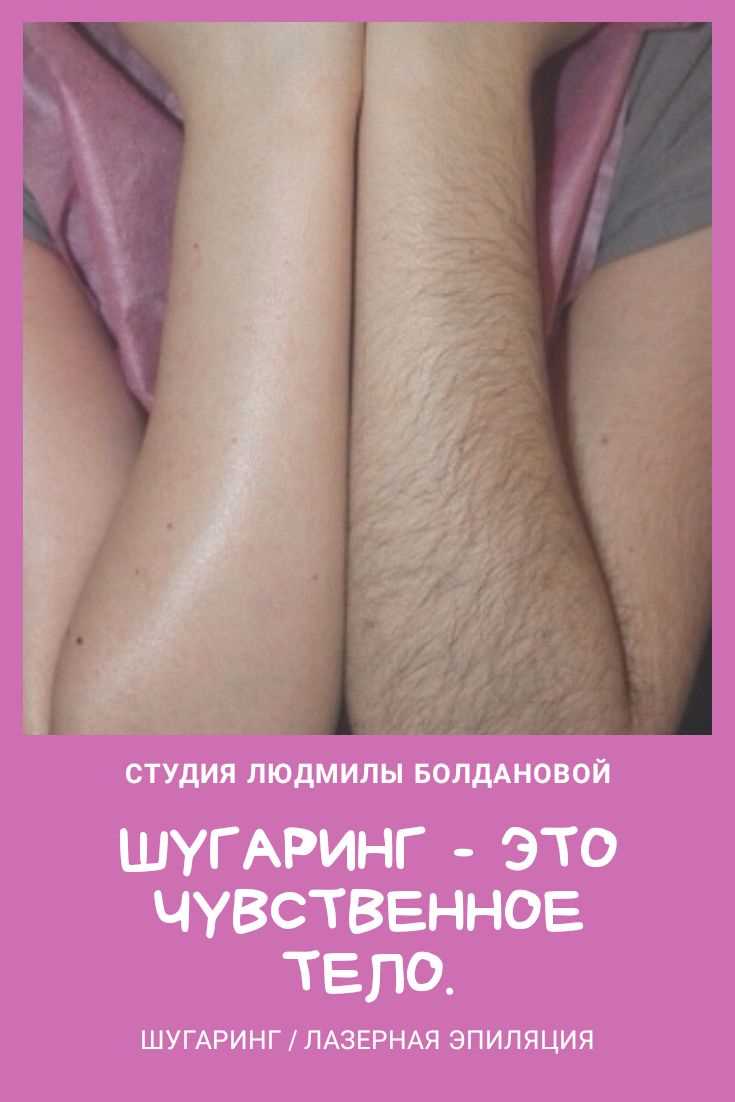Преимущества шугаринга перед другими видами депиляции