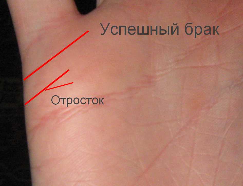 Техники и инструменты гадания по коже на руках